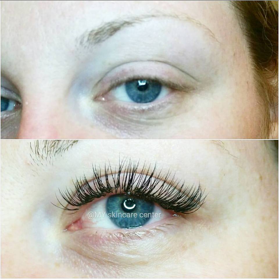 xtreme eyelashes before & after